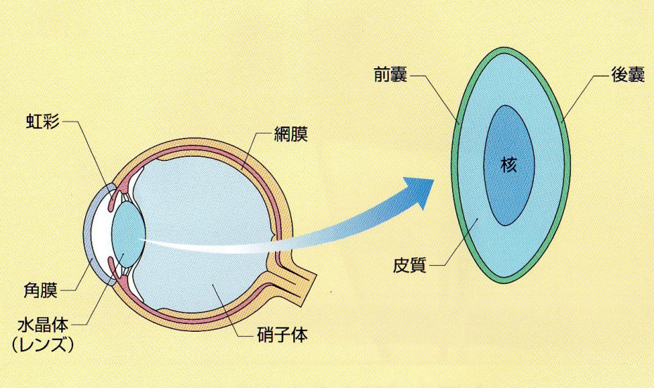 白内障とは