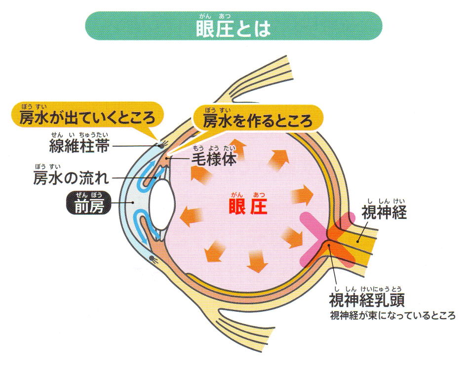 緑内障とは